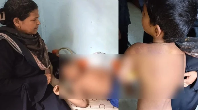 মাদরাসা শিক্ষকের বেধড়ক পিটুনিতে মেরুদণ্ডের হাড় ভাঙল শিক্ষার্থীর